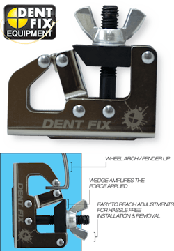 6656e79c0c08c3721fd65209 Dentfixdfwa202wheelarchcl 11415892 6656e79c0c08c3721fd65209 Dentfixdfwa202wheelarchcl 11415892