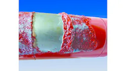 6656f83739335f41a1ccedaf Solvent Kleene D Zolve 1220 6656f83739335f41a1ccedaf Solvent Kleene D Zolve 1220